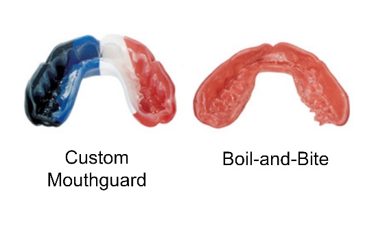 Boil and deals bite mouth guard